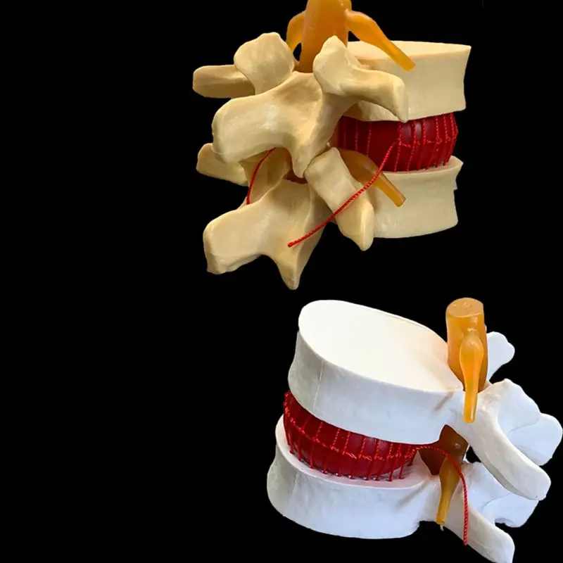 Anatomical Human Lumbar Verteb - Examination Bed Medical ulasan dan harga