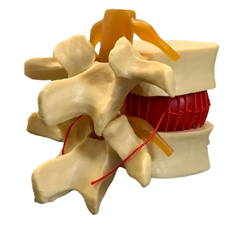Anatomical Human Lumbar Verteb - Examination Bed Medical ulasan dan harga