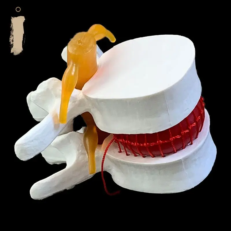 Anatomical Human Lumbar Verteb - Examination Bed Medical ulasan dan harga