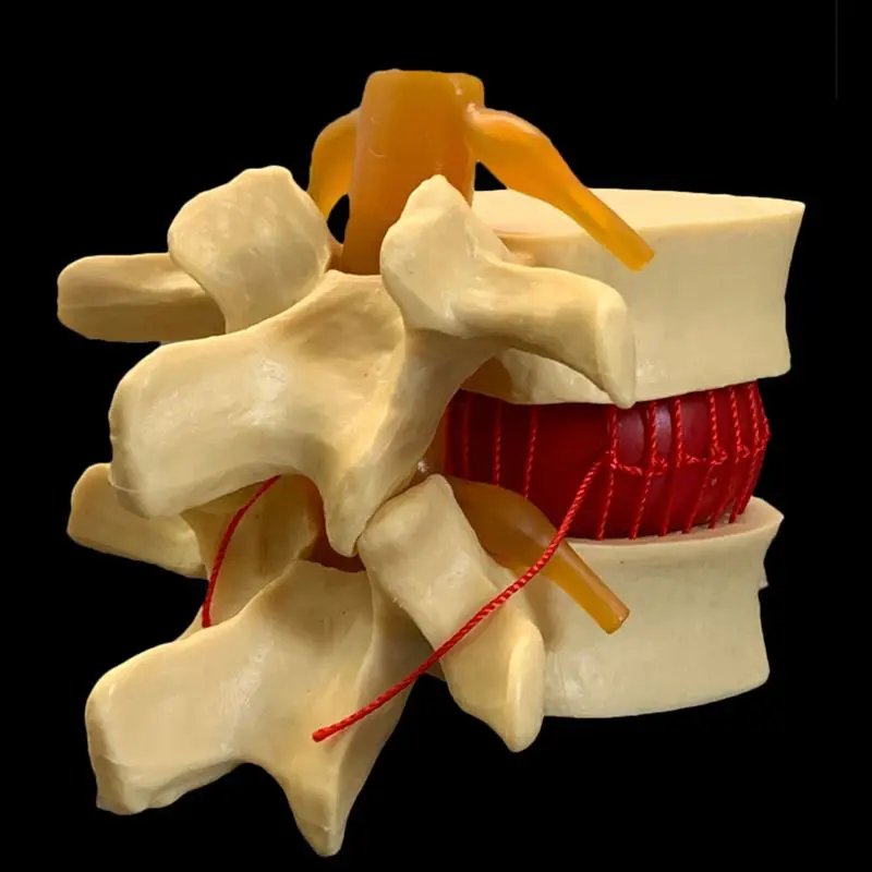 Anatomical Human Lumbar Verteb - Examination Bed Medical ulasan dan harga